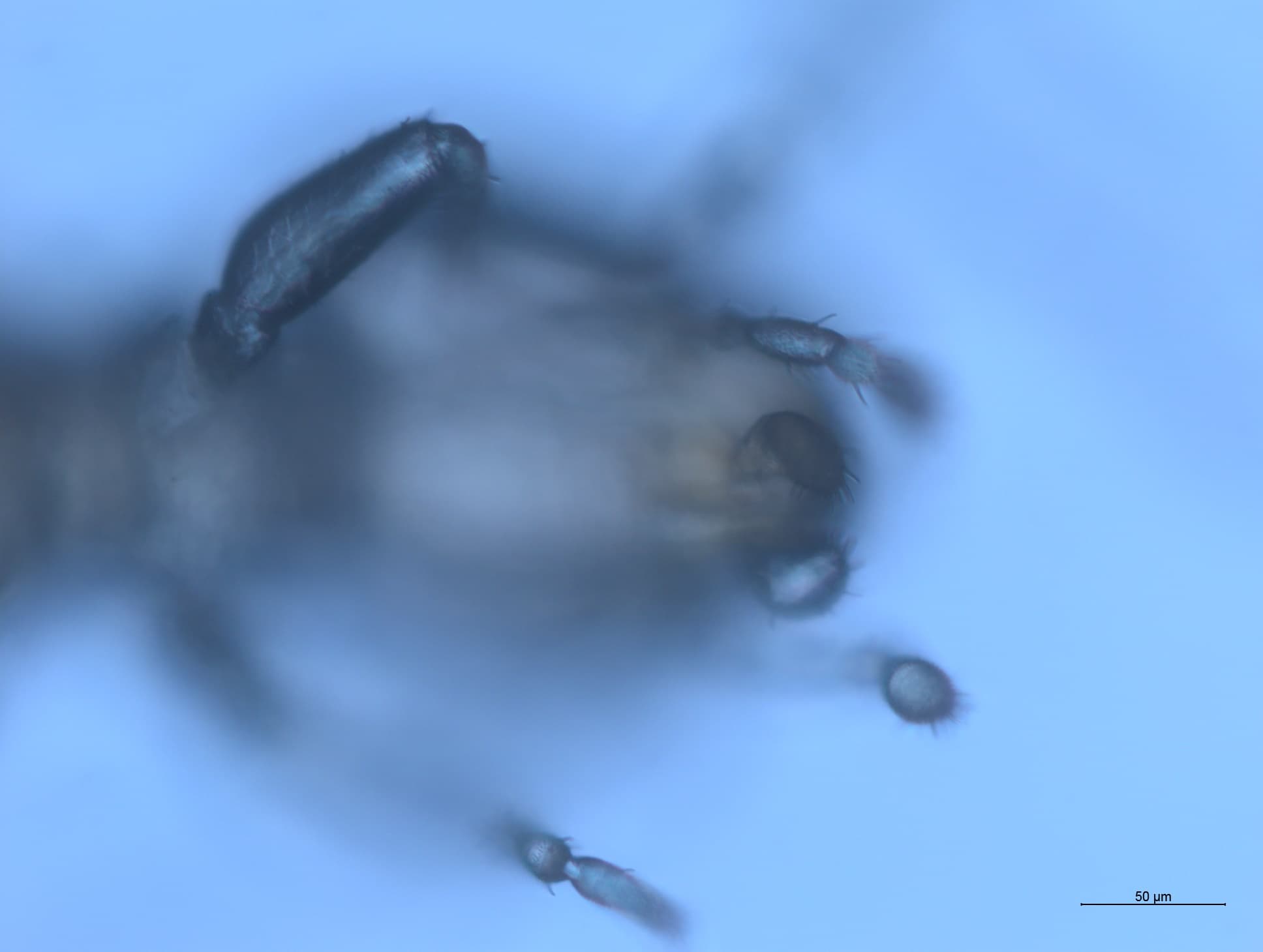 チャタテムシの接写画像 11